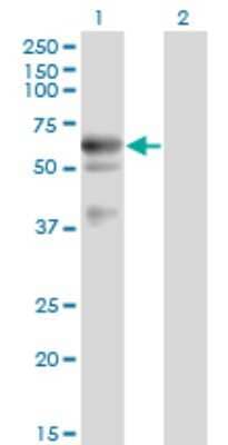 Western Blot: Endothelial Lipase Antibody (1E11) [H00009388-M02]