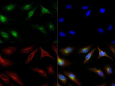 Immunocytochemistry/ Immunofluorescence: Endothelial Lipase Antibody [NB400-111]