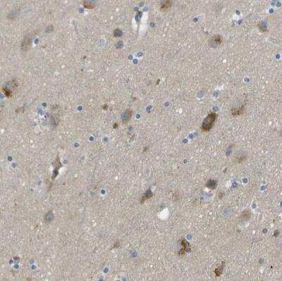 Immunohistochemistry-Paraffin: Endothelial Lipase Antibody [NBP1-84898]