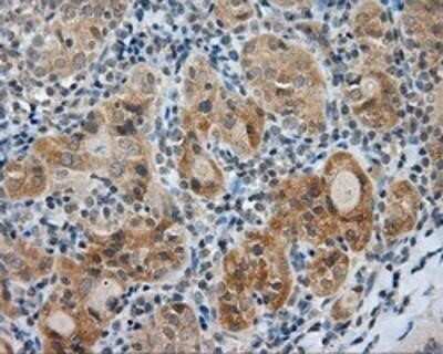 Immunohistochemistry: Endothelial Lipase Antibody (OTI1D9) - Azide and BSA Free [NBP2-71309]