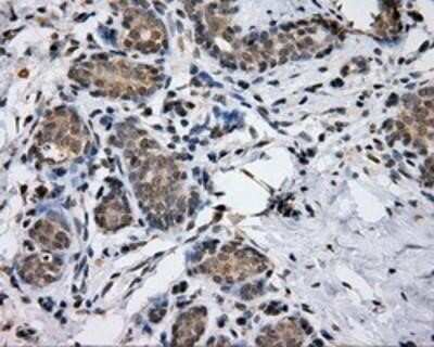 Immunohistochemistry: Endothelial Lipase Antibody (OTI1D9) - Azide and BSA Free [NBP2-71309]