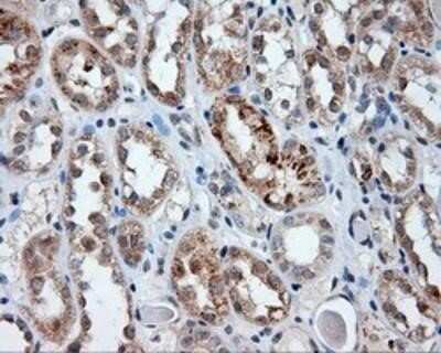 Immunohistochemistry: Endothelial Lipase Antibody (OTI1D9) - Azide and BSA Free [NBP2-71309]