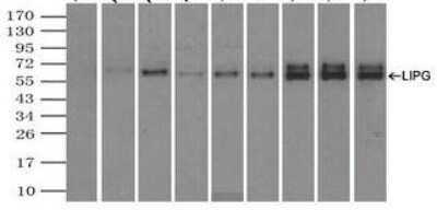 Immunoprecipitation: Endothelial Lipase Antibody (OTI1D9) - Azide and BSA Free [NBP2-71309]