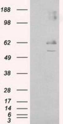 Western Blot: Endothelial Lipase Antibody (OTI1D9)Azide and BSA Free [NBP2-71309]