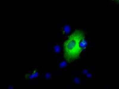 Immunocytochemistry/ Immunofluorescence: Endothelial Lipase Antibody (OTI1D9) [NBP2-02396]