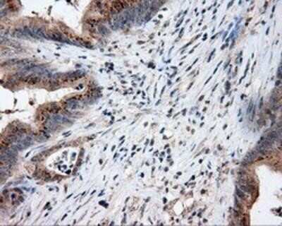 Immunohistochemistry-Paraffin: Endothelial Lipase Antibody (OTI1D9) [NBP2-02396]