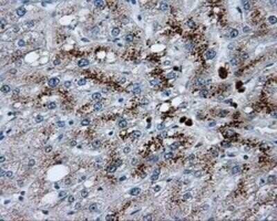 Immunohistochemistry-Paraffin: Endothelial Lipase Antibody (OTI1D9) [NBP2-02396]