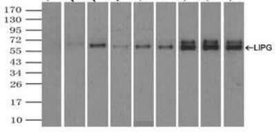Immunoprecipitation: Endothelial Lipase Antibody (OTI1D9) [NBP2-02396]