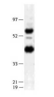 Western Blot: Endothelial Lipase Antibody [NB400-118]