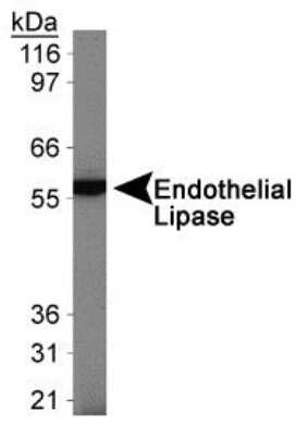 Western Blot: Endothelial Lipase Antibody [NB400-118]