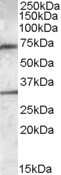 Western Blot: Endothelial Lipase Antibody [NBP1-05031]