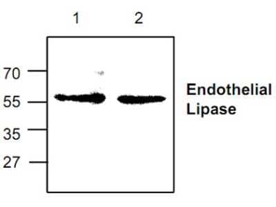 Western Blot: Endothelial Lipase Antibody [NBP1-45541]