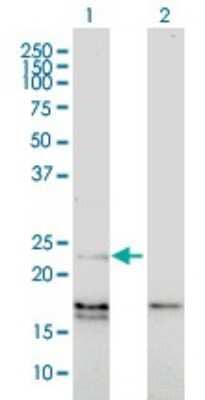 Western Blot: Endothelin-1 Antibody (3D6) [H00001906-M01]