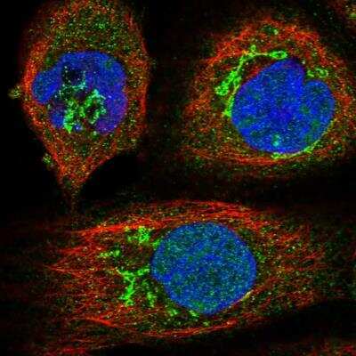 Immunocytochemistry/ Immunofluorescence: Endothelin-1 Antibody [NBP1-84779]