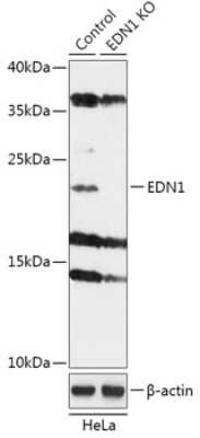 Knockout Validated: Endothelin-1 Antibody - Azide and BSA Free [NBP3-03533]