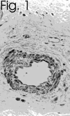 Immunohistochemistry: Endothelin-1 Antibody (TR.ET.48.5) - BSA Free [NB300-526]
