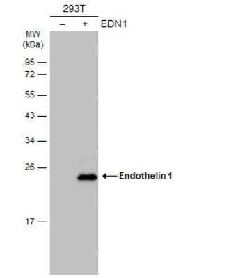 Western Blot: Endothelin-1 Antibody [NBP1-33613]