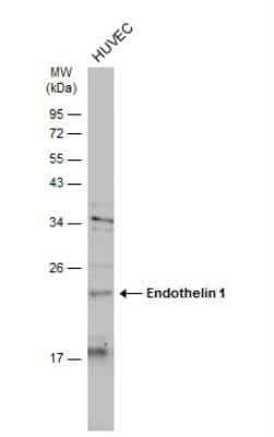 Western Blot: Endothelin-1 Antibody [NBP1-33613]