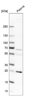 Western Blot: Endothelin-1 Antibody [NBP1-84779]