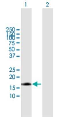 Western Blot: Endothelin 2 Antibody [H00001907-B01P]