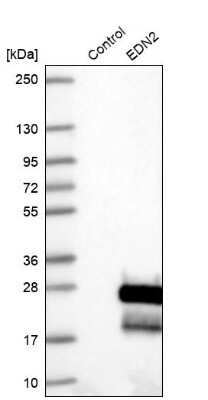 Western Blot: Endothelin 2 Antibody [NBP1-87942]