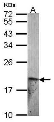 Western Blot: Endothelin 2 Antibody [NBP2-16333]