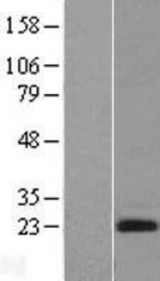 Western Blot: Endothelin 2 Overexpression Lysate [NBL1-10114]