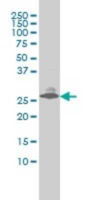Western Blot: Endothelin-3 Antibody (2A6-2A4) [H00001908-M01]