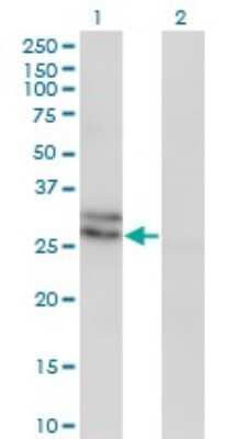 Western Blot: Endothelin-3 Antibody (2A6-2A4) [H00001908-M01]