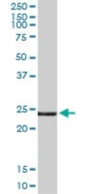 Western Blot: Endothelin-3 Antibody [H00001908-D01P]