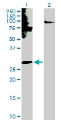 Western Blot: Endothelin-3 Antibody [H00001908-D01P]