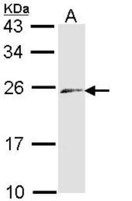 Western Blot: Endothelin-3 Antibody [NBP1-33578]