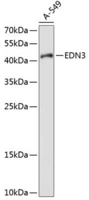 Western Blot: Endothelin-3 AntibodyBSA Free [NBP3-03508]