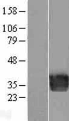 Western Blot: Endothelin-3 Overexpression Lysate [NBP2-04517]