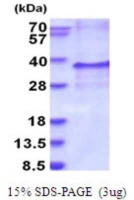 SDS-PAGE: Recombinant Human Endothelin-3 His Protein [NBP2-51961]