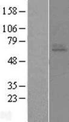 Western Blot: EDNRA/Endothelin R Type A Overexpression Lysate [NBL1-10117]