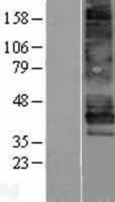 Western Blot: EDNRB/Endothelin R Type B Overexpression Lysate [NBP2-04148]