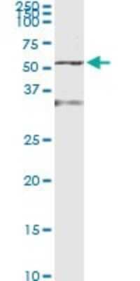 Western Blot: Enolase 1 Antibody (8G8) [H00002023-M01]