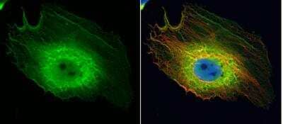 Immunocytochemistry/ Immunofluorescence: Enolase 1 Antibody [NBP1-31324]