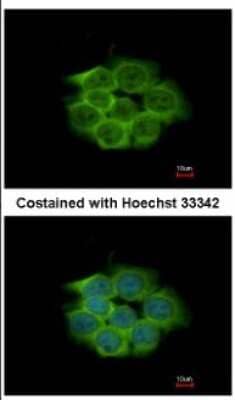 Immunocytochemistry/ Immunofluorescence: Enolase 1 Antibody [NBP2-16337]