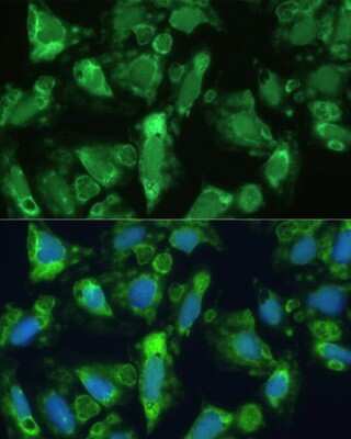 Immunocytochemistry/ Immunofluorescence: Enolase 1 Antibody - Azide and BSA Free [NBP3-03484]