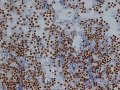 Immunohistochemistry: Enolase 1 Antibody [NB100-65252]