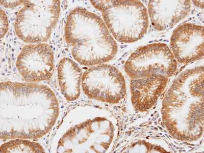 Immunohistochemistry-Paraffin: Enolase 1 Antibody [NBP1-31324]