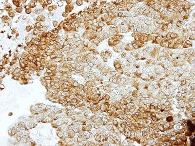 Immunohistochemistry-Paraffin: Enolase 2/Neuron-specific Enolase Antibody [NBP1-32090]