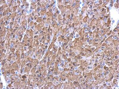 Immunohistochemistry-Paraffin: Enolase 1 Antibody [NBP2-16337]