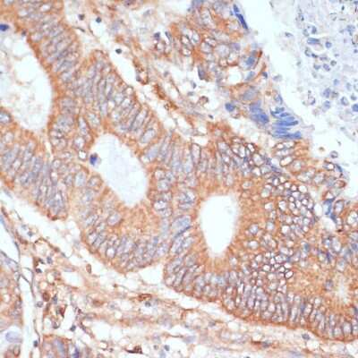 Immunohistochemistry-Paraffin: Enolase 1 Antibody - Azide and BSA Free [NBP3-03484]