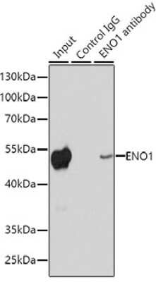 Immunohistochemistry-Paraffin: Enolase 1 Antibody - Azide and BSA Free [NBP3-03484]