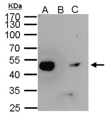 Immunoprecipitation: Enolase 1 Antibody [NBP2-16337]