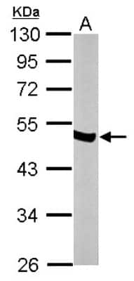 Western Blot: Enolase 2/Neuron-specific Enolase Antibody [NBP1-32090]