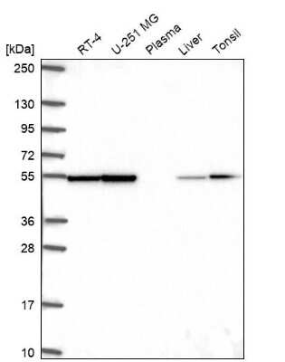 Western Blot: Enolase 1 Antibody [NBP2-68874]